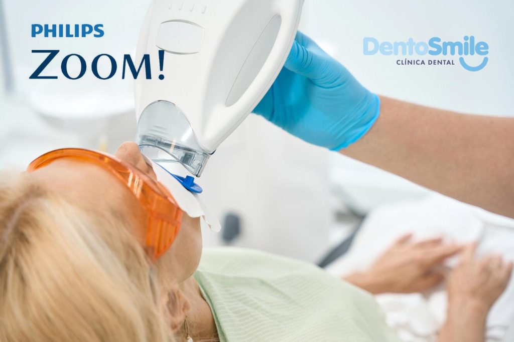 blanqueamiento dental alcalá de henares